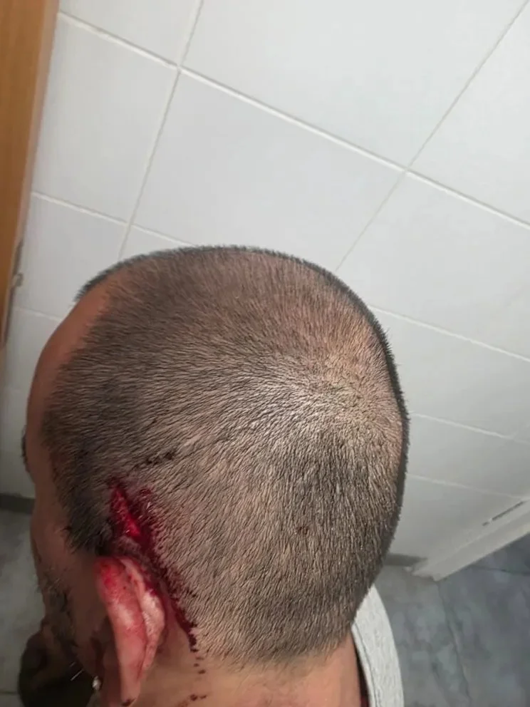 Si bien la víctima se encuentra fuera de peligro, pide colaboración para encontrar al conductor por la violencia sufrida y la irresponsabilidad al volante.