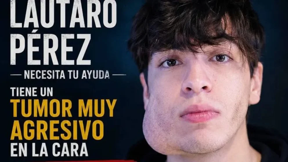 La enfermedad, aunque benigna, avanza muy rápido. La operación debe hacerse lo más pronto posible. Foto: gentileza.