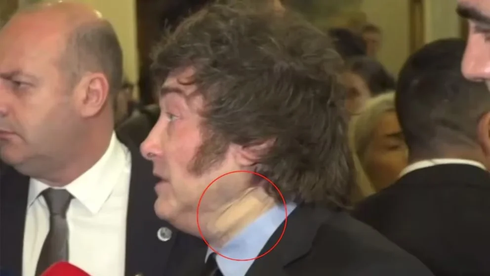 El llamativo vendaje que presentó en su cuello el presidente Javier Milei en sus actividades en España. Foto: Infobae